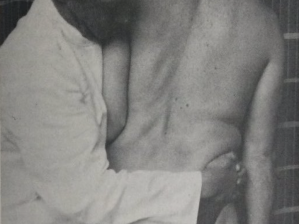 Robin McKenzie applying a lateral shift correction.